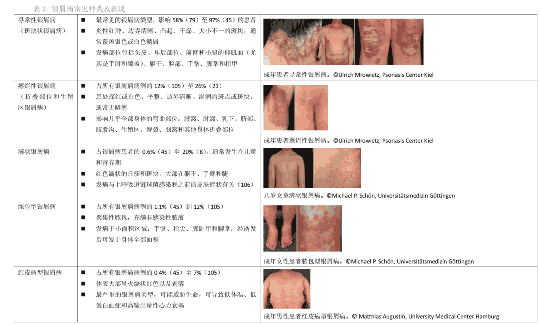 有些顽固性尿布疹，其实可能是银屑病